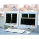 Patient Monitoring&nbsp;Central monitors, Telemetry monitoring systems, Transmitters, Bedside monitors, Sensors, Pulse oximeters, Hand held monitors
